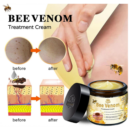 Bee Venom Crema Tratamiento Piel